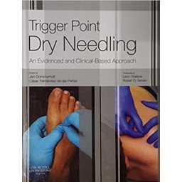 TRIGGER POINT DRY NEEDLING. AN EVIDENCE AND CLINICAL-BA